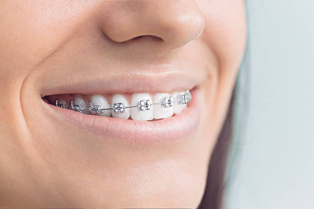 Dental Inlays and Onlays in Evanston, IL